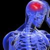 Как проявляется недостаток кислорода в головном мозге